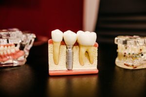 5 Tips to Hire a Dental Marketing Company for the First Time