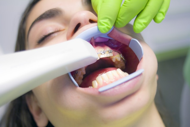 What to Expect During Your First Appointment for Braces in Carlsbad